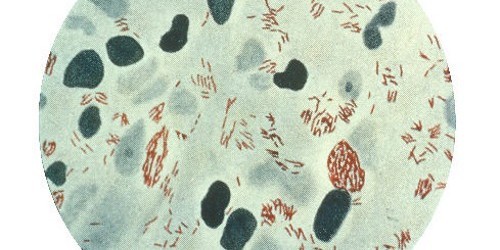 Mycobacterium-leprae-500x250.jpg